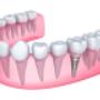 # 3