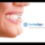 Invisalign